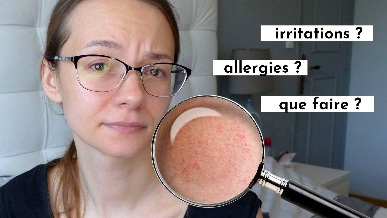 ALLERGIES ? IRRITATIONS ? MES RECOMMANDATIONS !