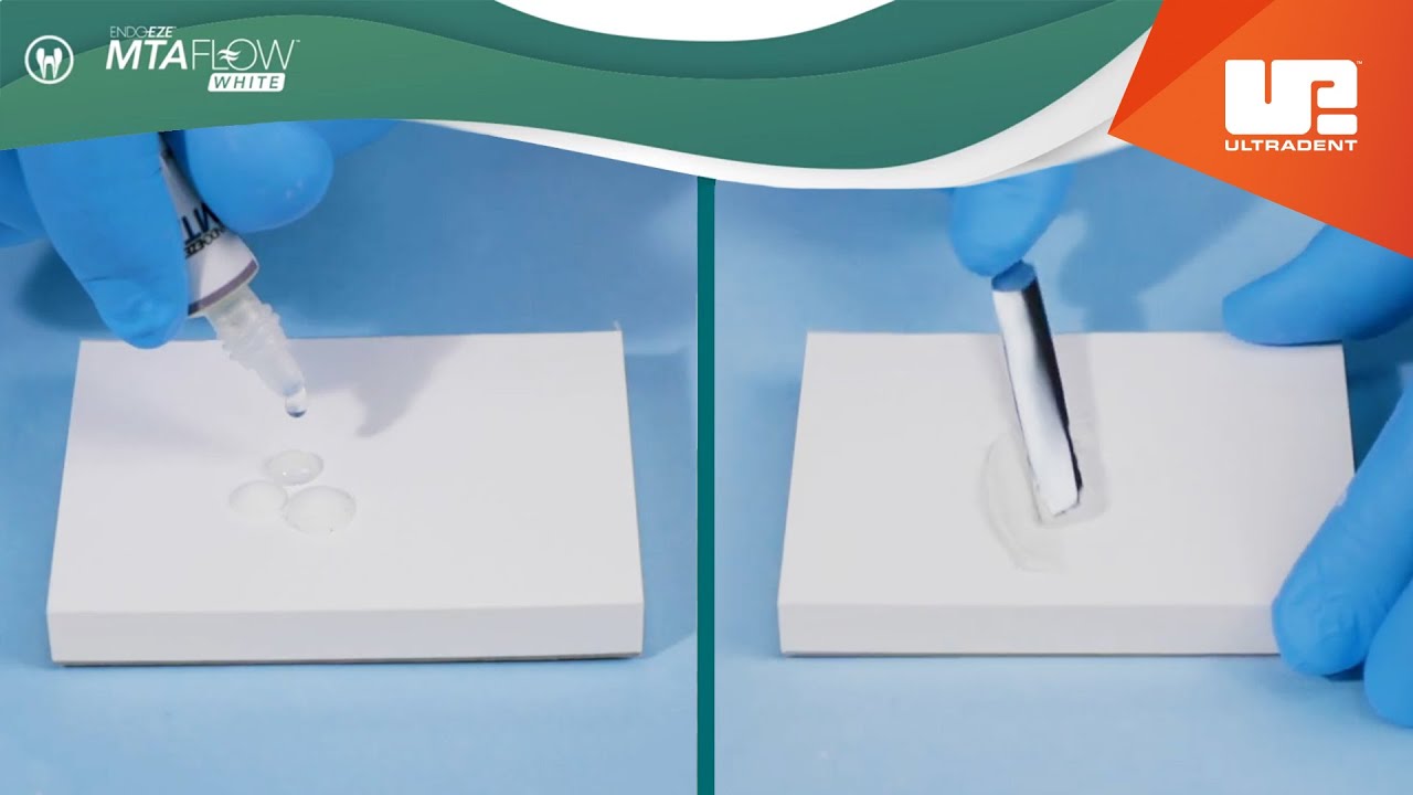 MTAFlow repair cement | Mixing and NaviTip Delivery