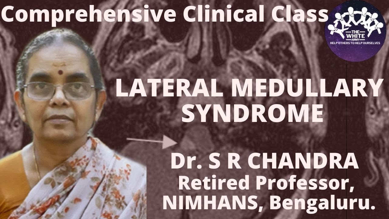 Lateral Medullary Syndrome Case presentation