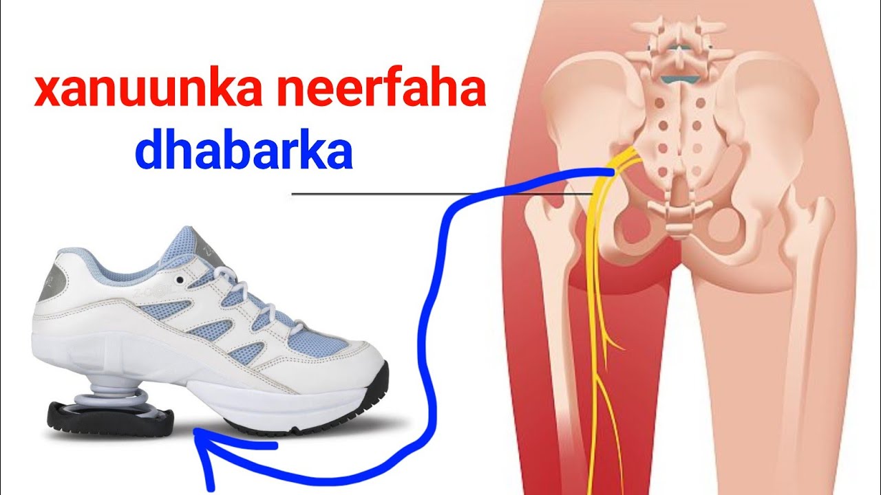 Neerfa Xanuunka dhabarka qeeybta hoose iyo kabaha aa xerato xiriirka ka dhaxeeyo 
