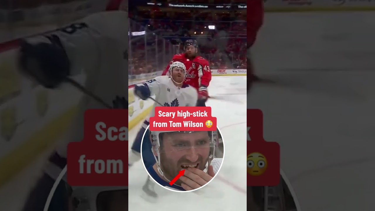 Scary high-stick from Tom Wilson 😳