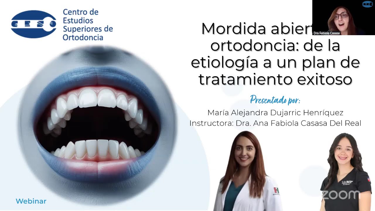 Mordida abierta en ortodoncia: de la etiología a un plan de tratamiento exitoso | Webinar CESO