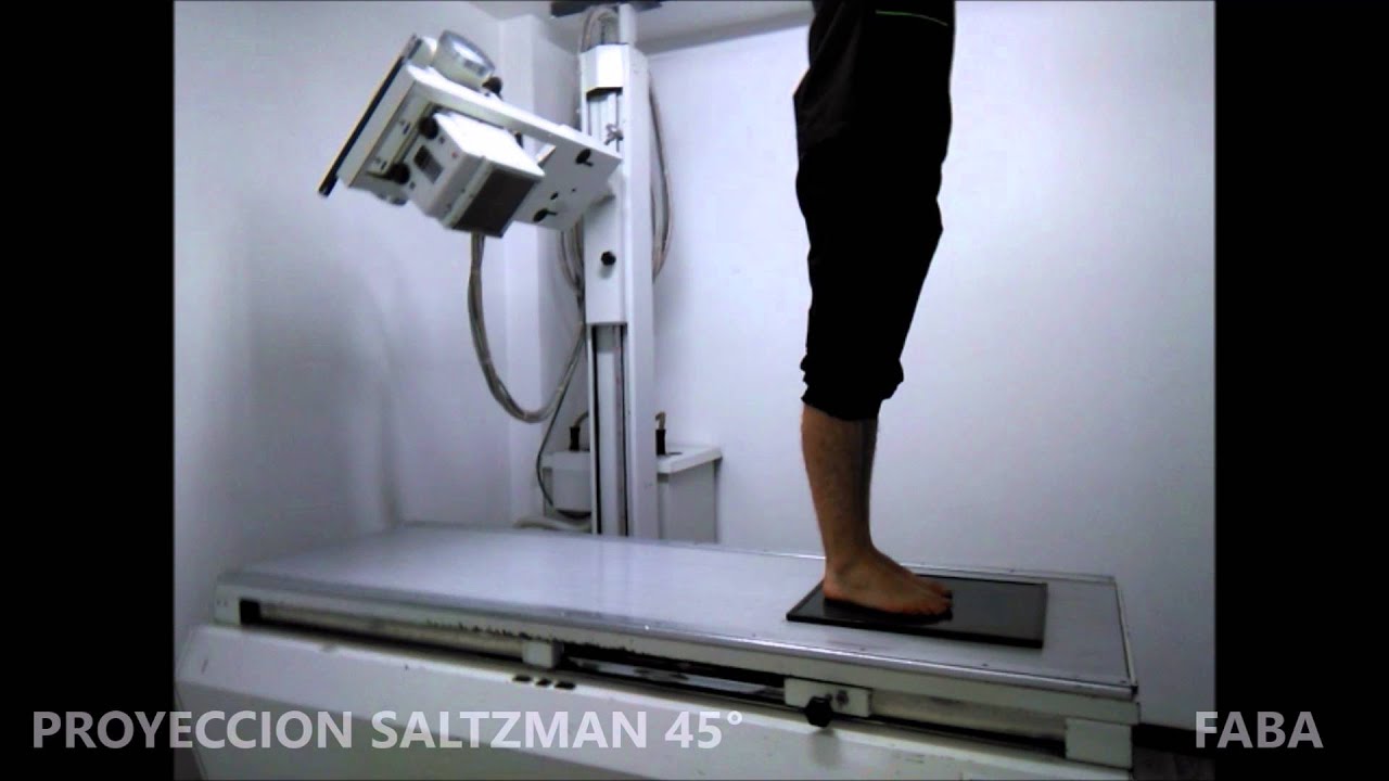 SALTZMAN 45°