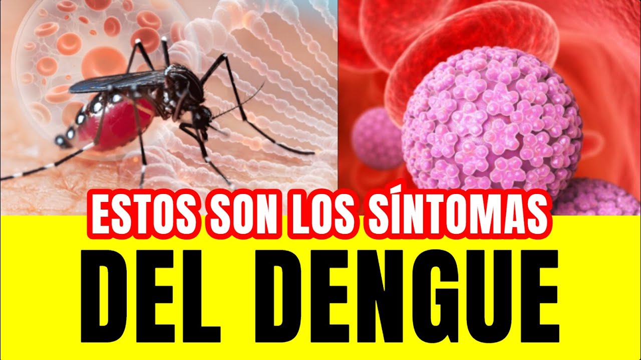 🔴 DENGUE | Cómo CURARLO, Síntomas y Peligros, Cómo EVITAR el Dengue