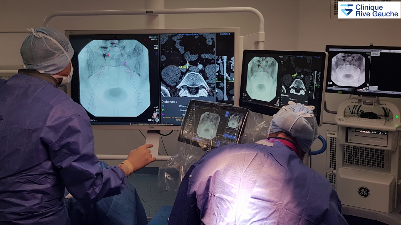 Chirurgie vasculaire : nouveauté dans la salle hybride avec EndoNaut - Clinique Rive Gauche