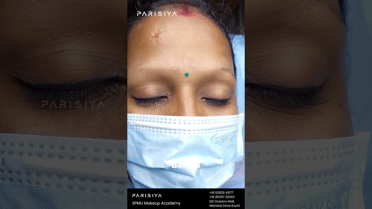 Eyebrow Microblading | Before & After Of Microblading