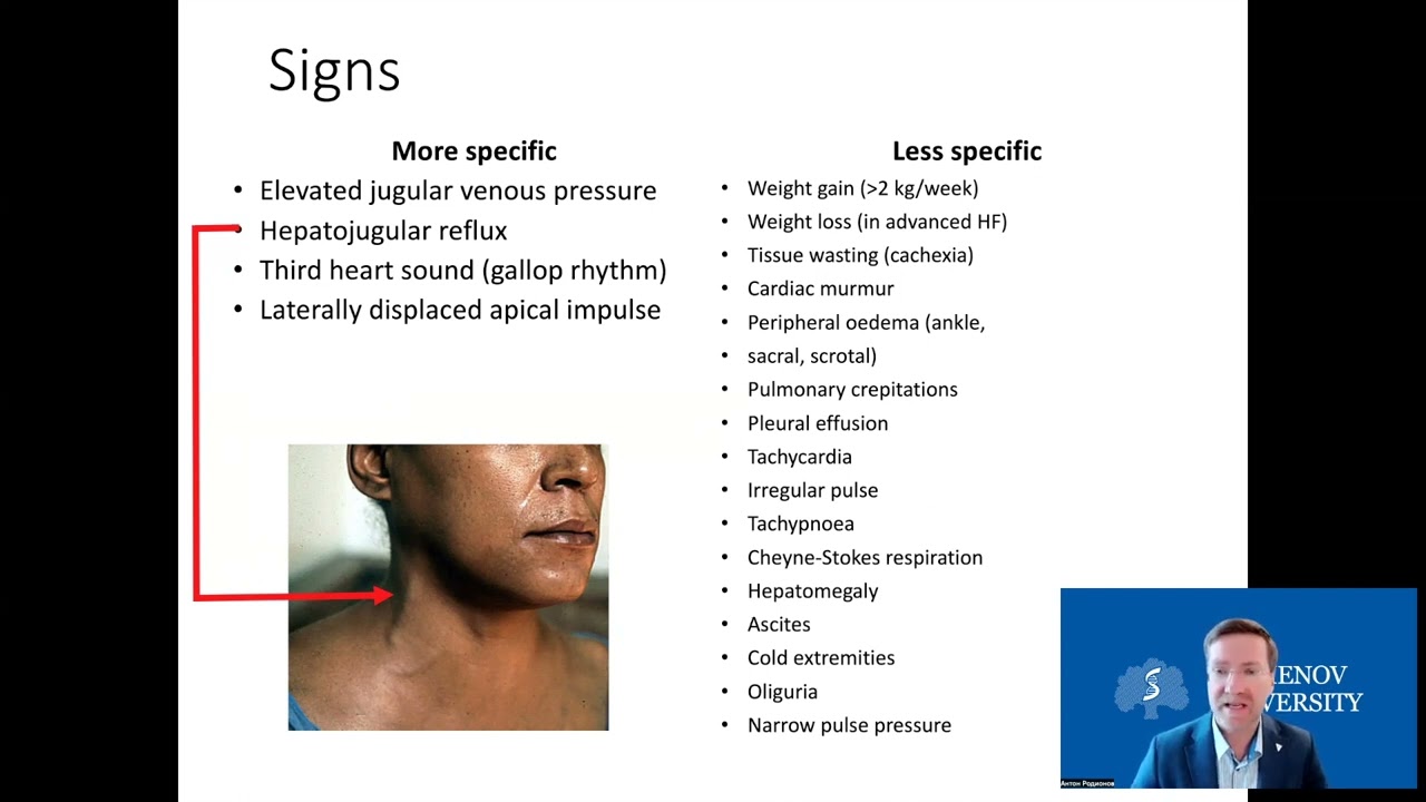 Heart failure (english) A. Rodionov