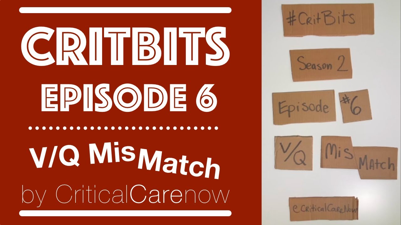 Эпизод 6: ПРОСТО ОБЪЯСНЯЕТСЯ НЕСООТВЕТСТВИЕ V/Q