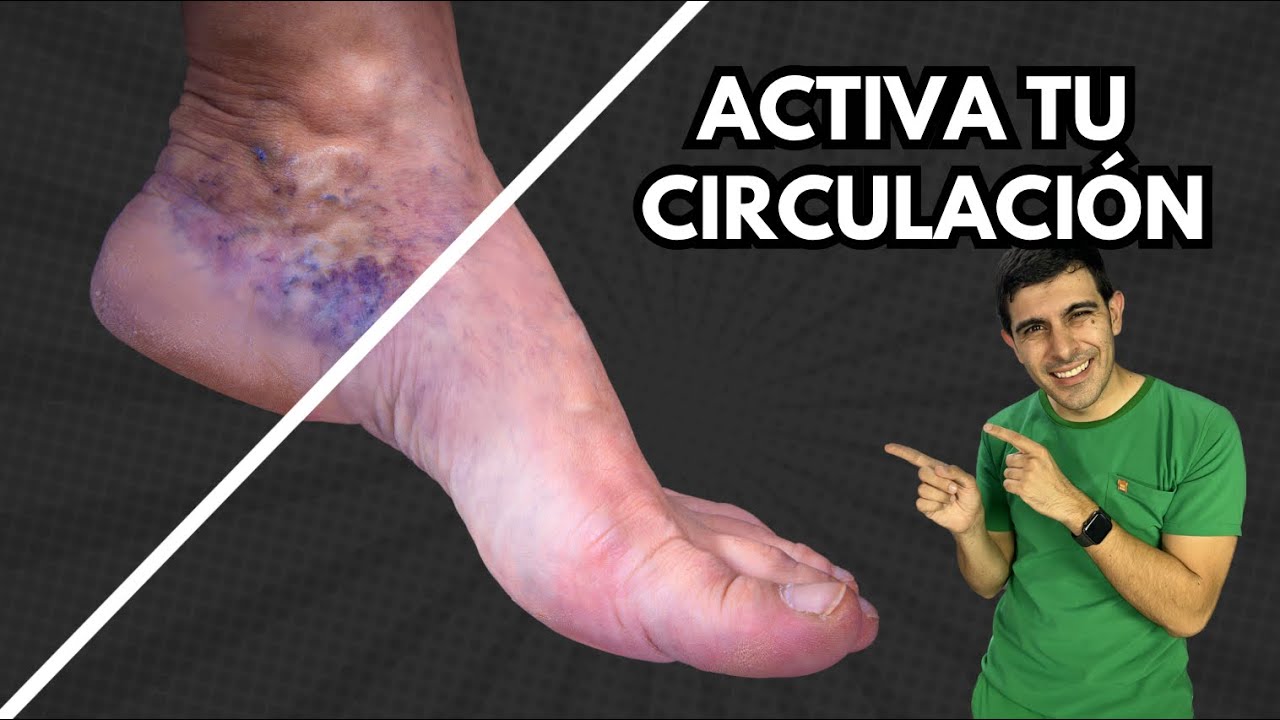 Activa la circulación de tus piernas para prevenir las varices al envejecer