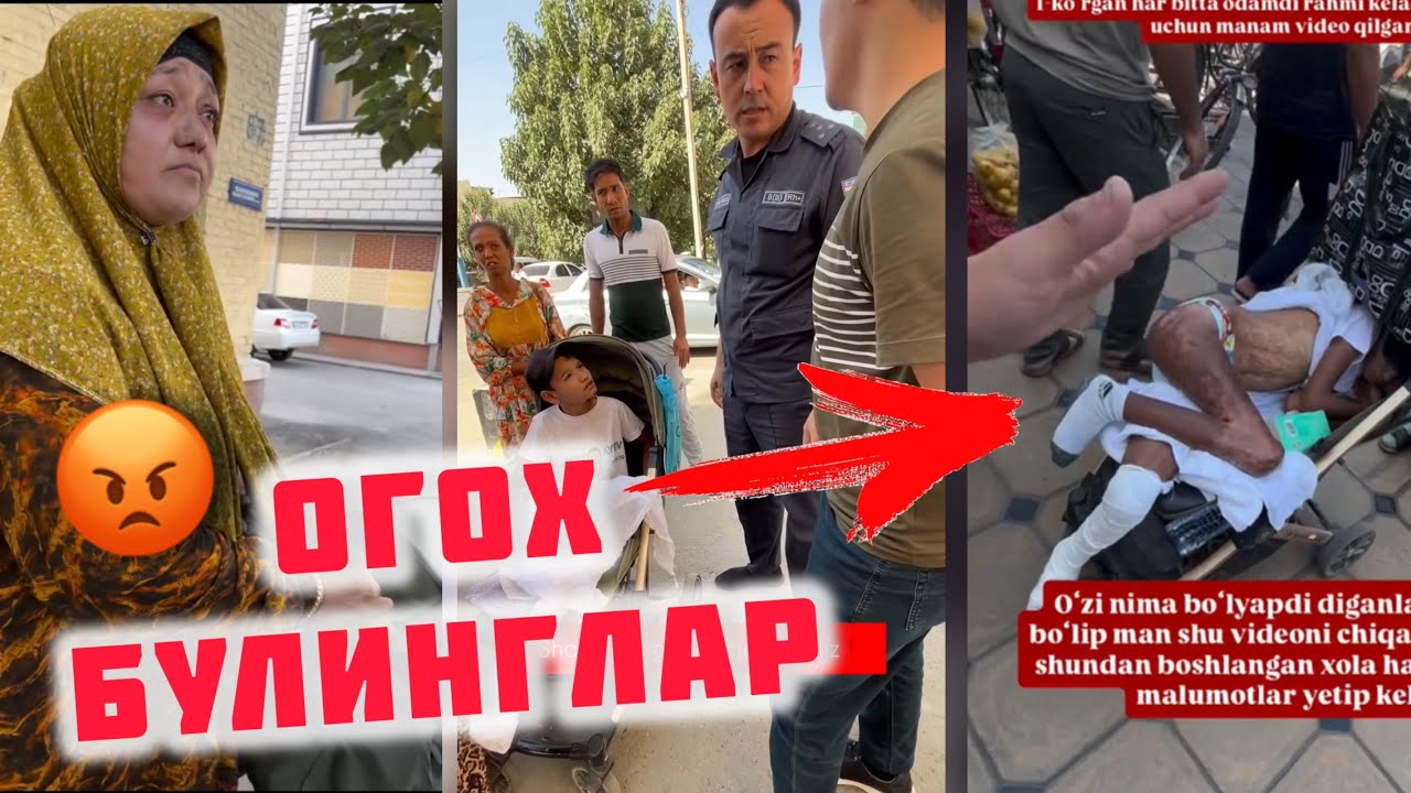 Oyog’i kuyib yopishib qolgan bolani arendaga olib odamlardan pul yig’ishayotgani aytilmoqda
