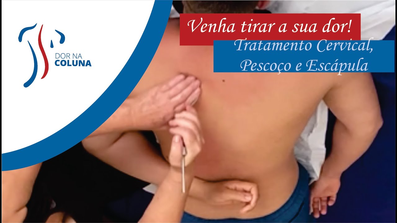 Alguém precisando de um tratamento na CERVICAL E ESCÁPULAS?