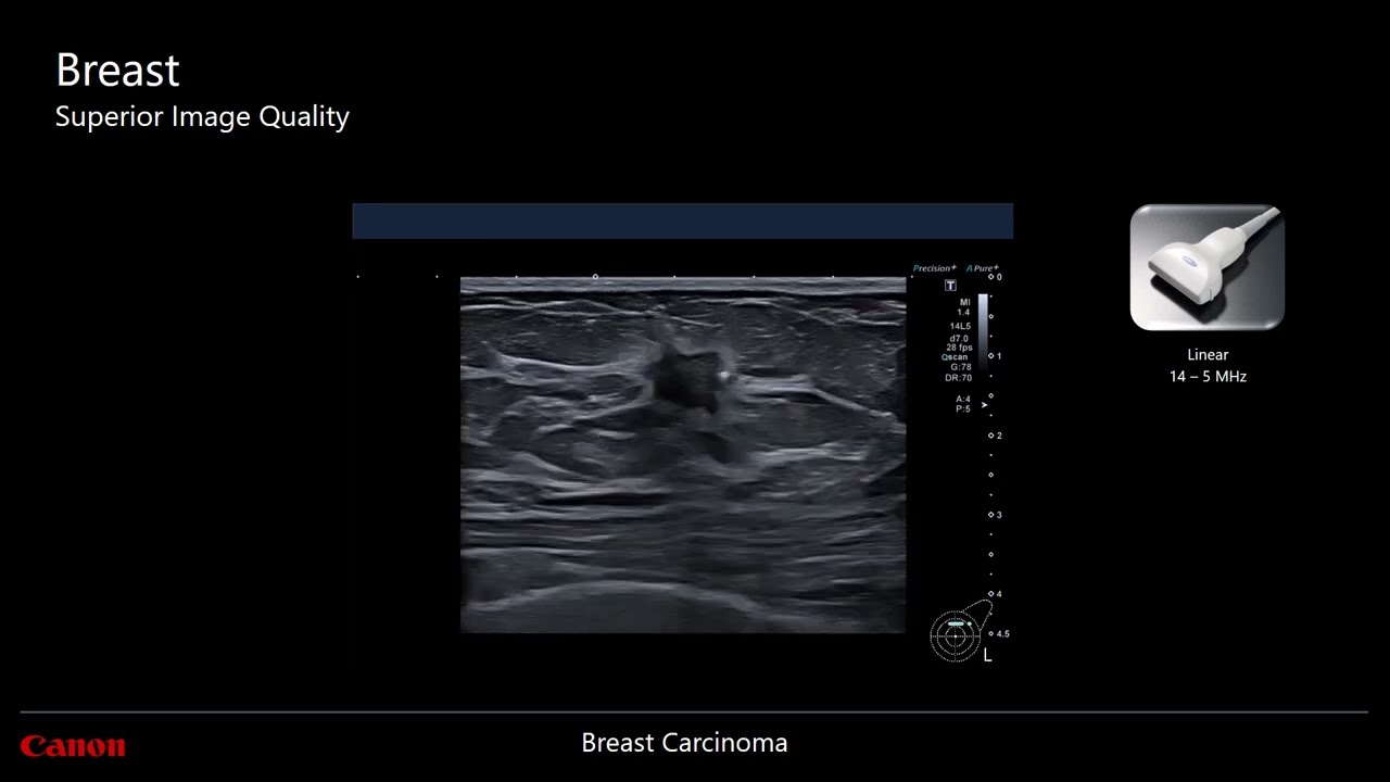 Canon Medical Systems _ BREAST imaging