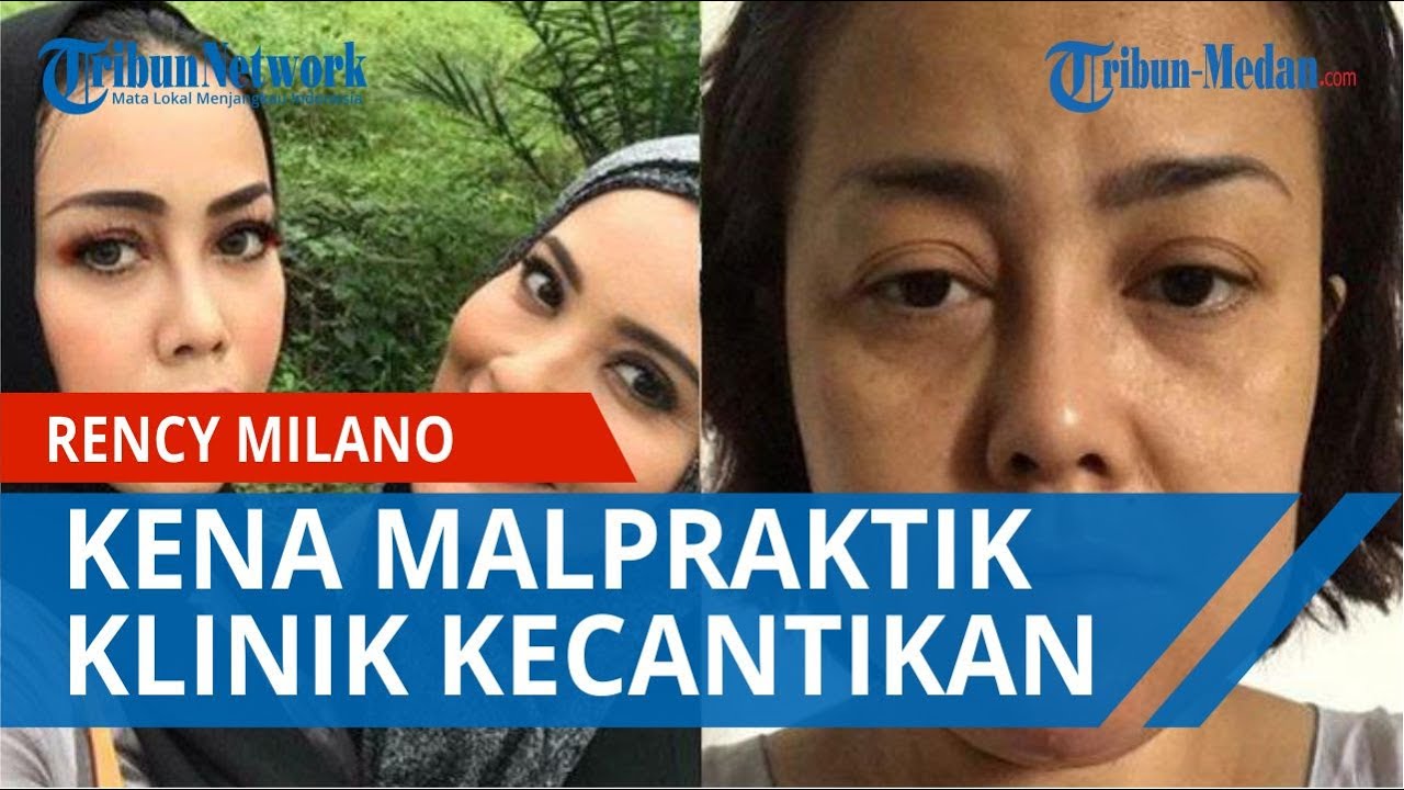 Artis Rency Milano Kena Malpraktik Klinik Kecantikan