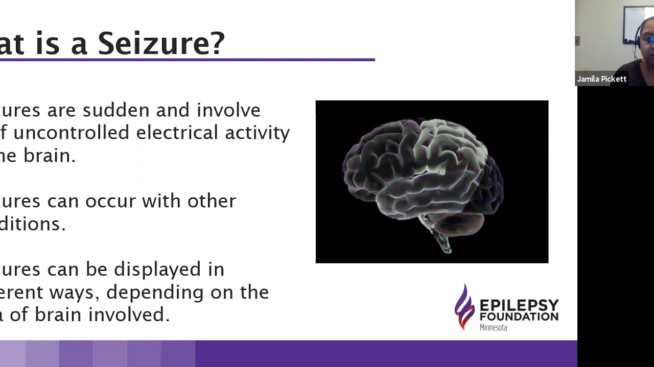 Focal Seizures 101 Webinar