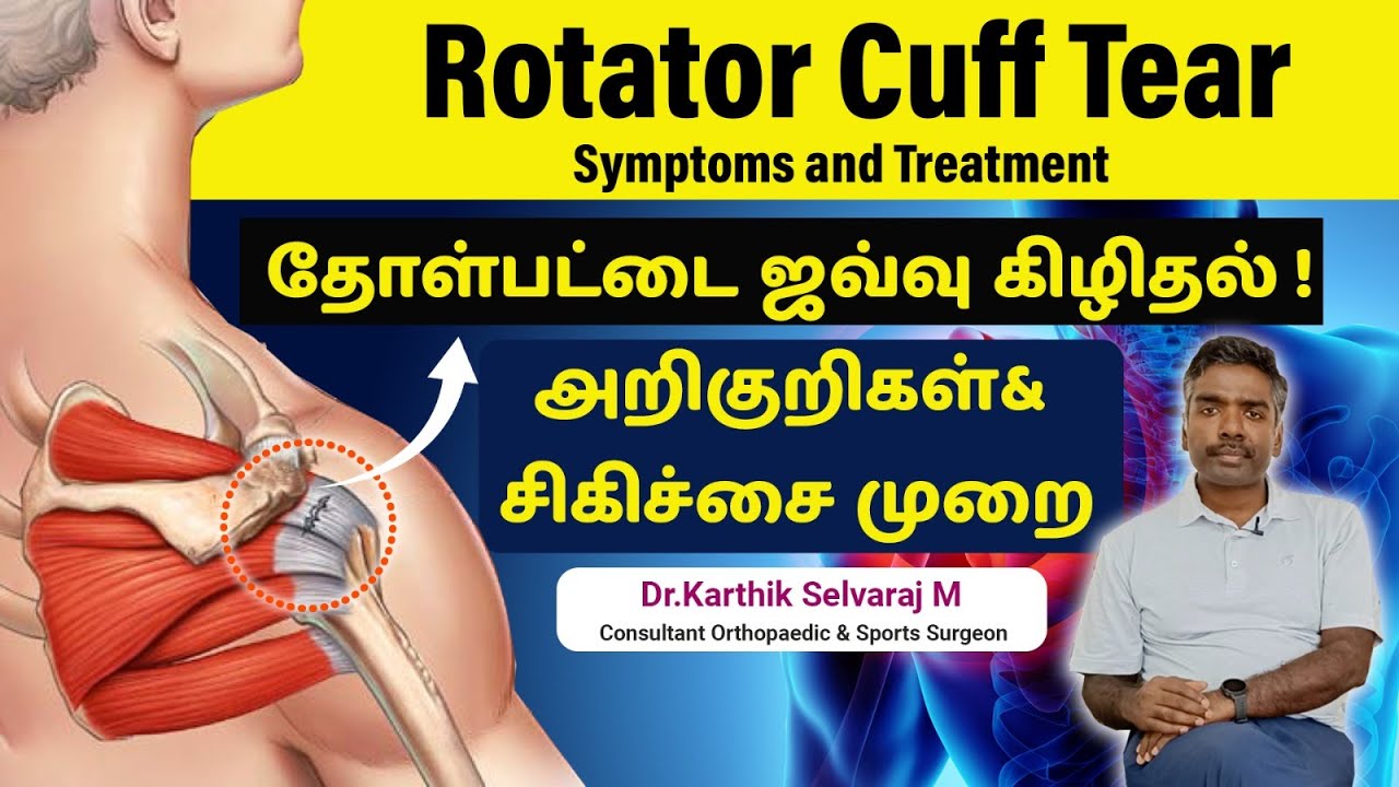 Shoulder Rotator Cuff Tear | தோள்பட்டை ஜவ்வு கிழிதல் அறிகுறிகள் சிகிச்சை முறை@drkarthikselvaraj