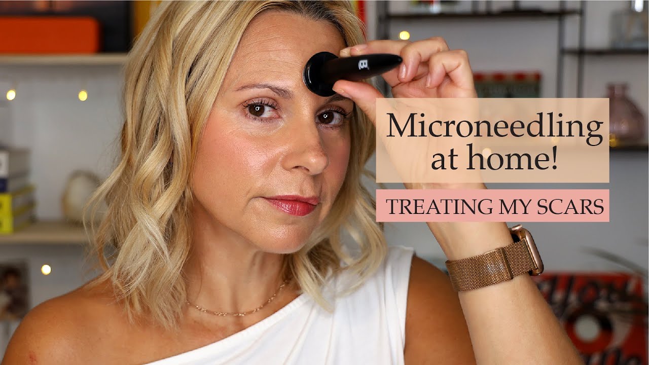Banish Microneedling Demo & Review | Best Beauty Products | Skin Obsessed Mary
