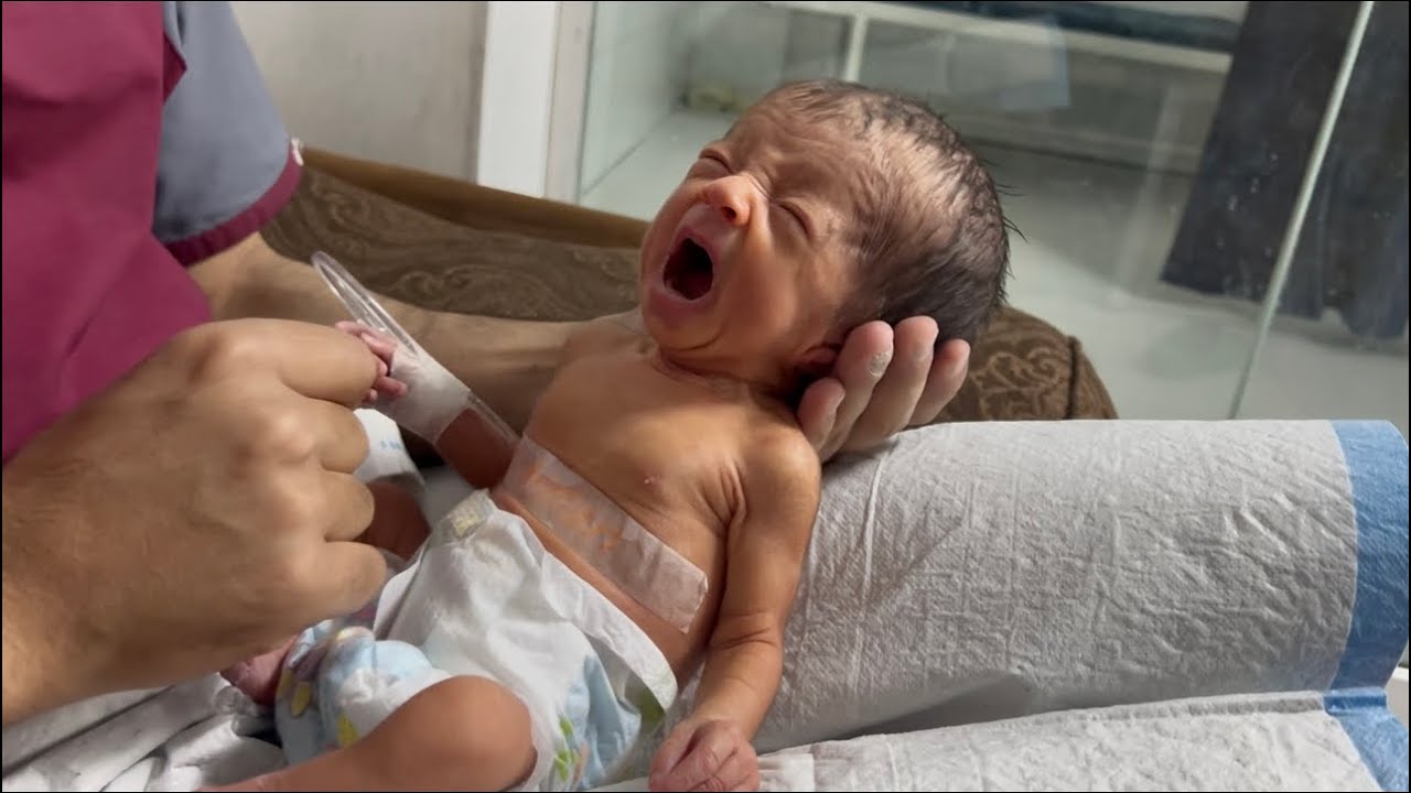 Tiny Hydrocephalus Baby Getting Better Day by Day | NICU Cute Moments👶💖