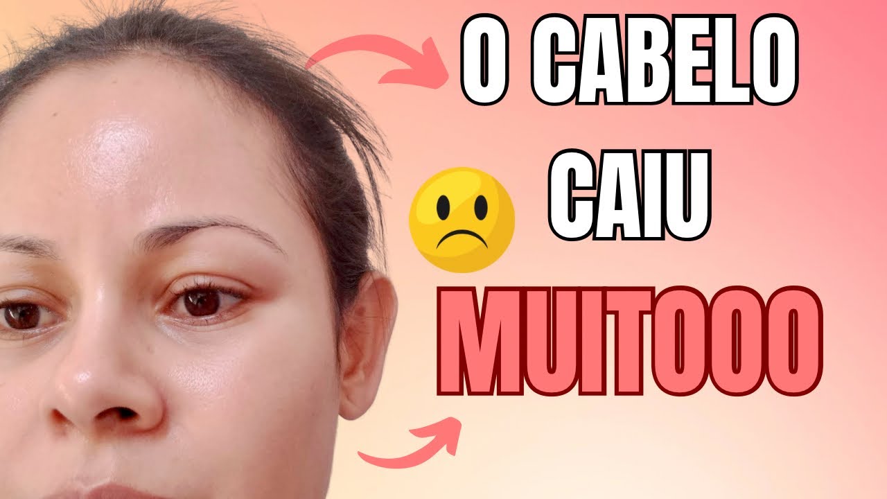 Por isso QUE seu CABELO CAI tanto! 🙄