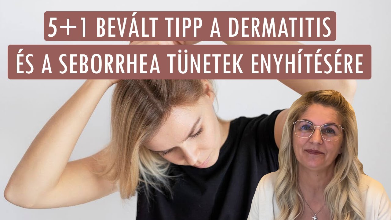☝️ Seborrhea &eacute;s dermatitis kezel&eacute;se otthon: 5+1 bev&aacute;lt tipp a t&uuml;netek enyh&iacute;t&eacute;s&eacute;re - hillvital.hu