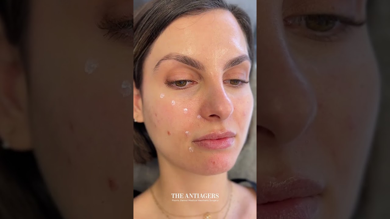 ✨ &Nu;&Epsilon;&Alpha; &Alpha;&Phi;&Iota;&Xi;&Eta;: RRS LoLa (Long Lasting) Skin Booster