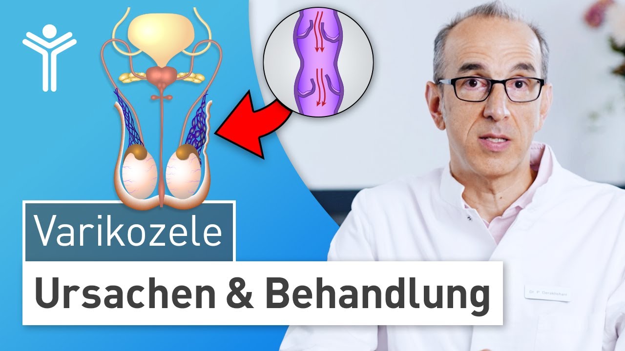 Krampfadern am Hoden: Hodenschmerzen durch Varikozele – Fruchtbarkeit gefährdet?