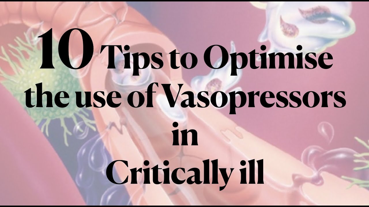10 tips to Optimise use of Vasopressors.