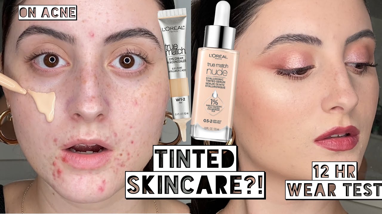 Best Makeup Day?? LOREAL TINTED HYALURONIC SERUM & EYECREAM ON ACNE | 10 Hour Wear Test