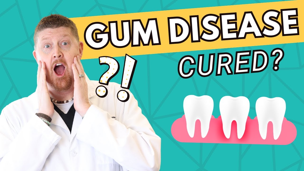 Can GUM DISEASE be Cured? | Symptoms, Oral Hygiene, & Treatment