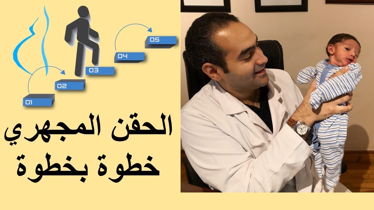 شرح خطوات الحقن المجهري - د. احمد حسين