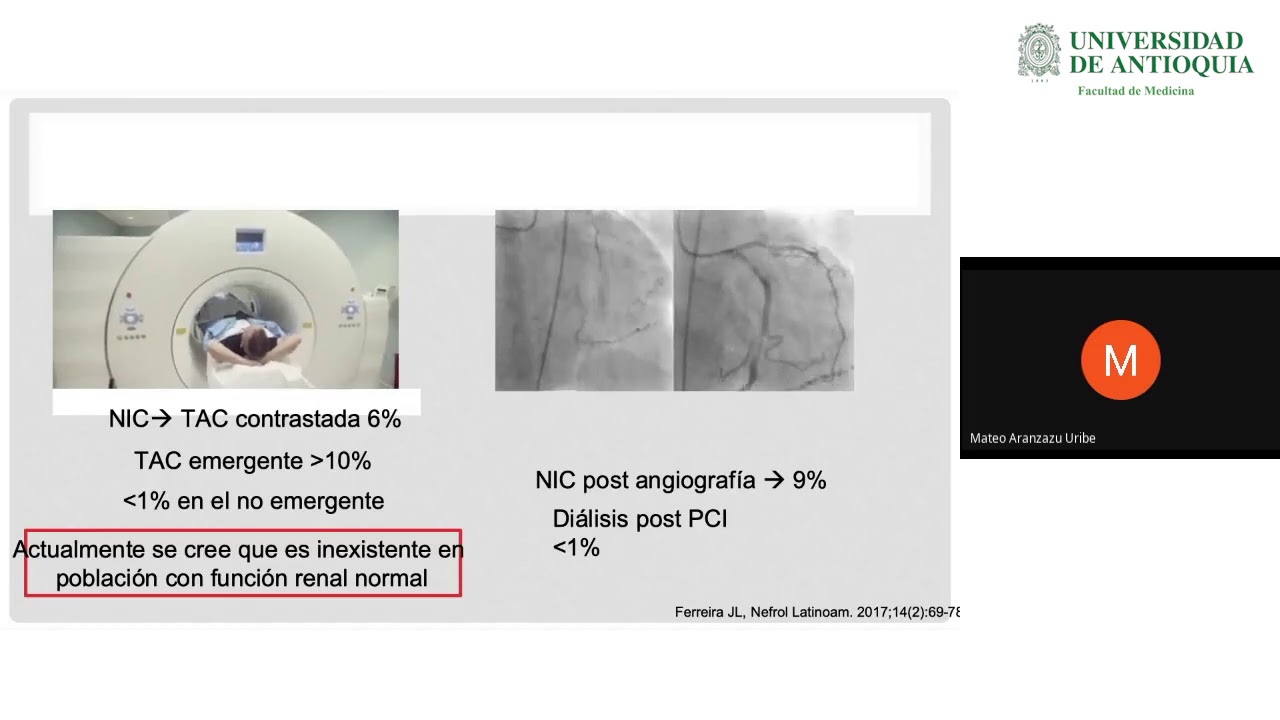 Lesión Renal por Contraste - Dr. Mateo Aranzazu