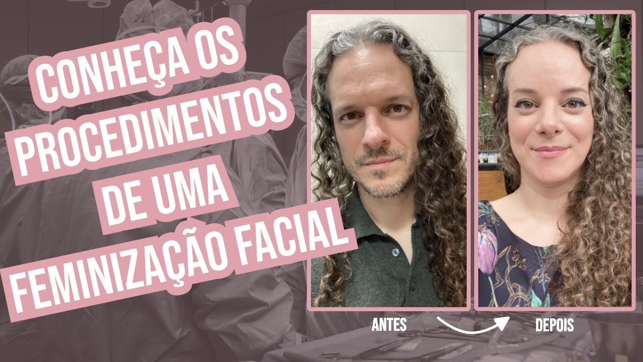 FEMINIZAÇÃO FACIAL - PROCEDIMENTOS!