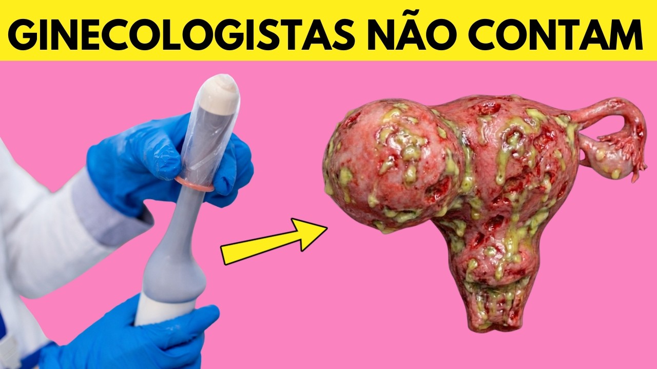 Nenhum MÉDICO explica isso sobre PAPANICOLAU e TRANSVAGINAL