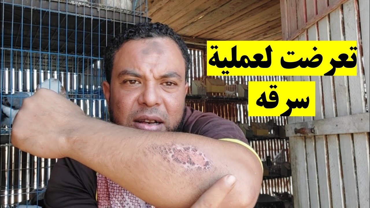 مش أنا اتسرقت 😎😎