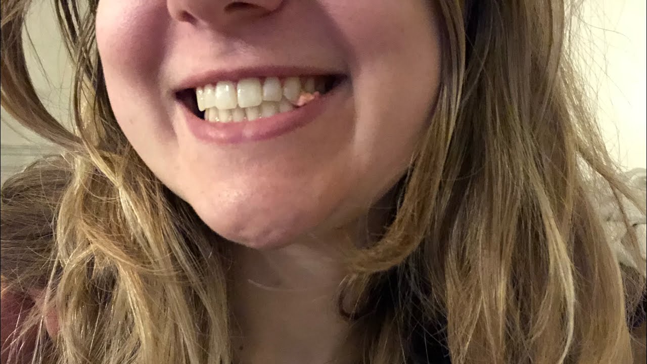 *One Hour* Gum Chewing *Up Close* | ASMR