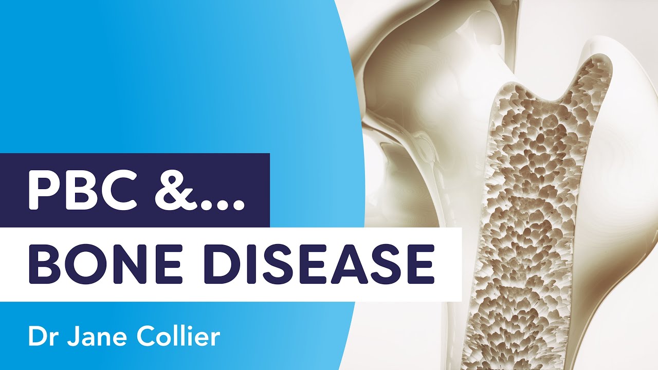 PBC and Bone disease | Dr Jane Collier