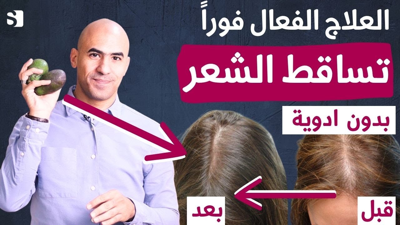 الحل النهائي لمشكلة تساقط الشعر بدون ادوية او وصفات | اهم اسباب تساقط الشعر في طعامك