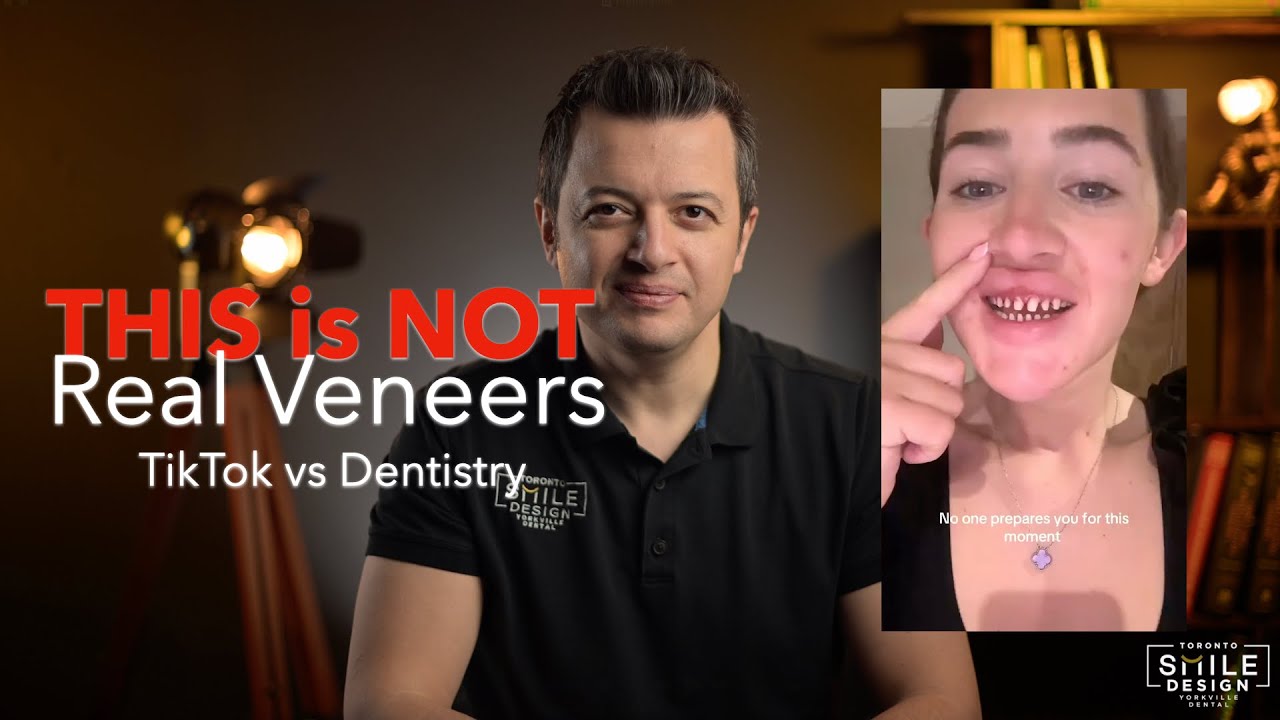 Porcelain Veneers Without Teeth Shaving? The Truth About No-Prep & Prepless Veneers