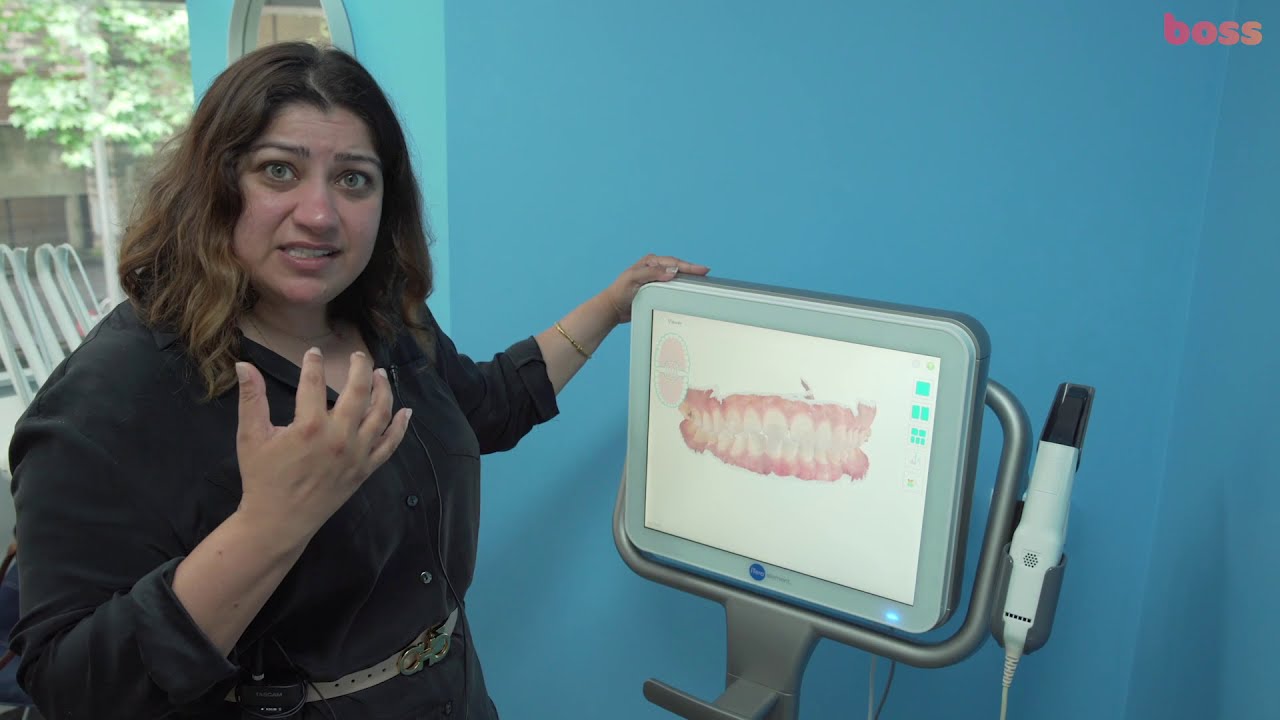 Invisalign Refinement Procedural tips for Class 3 open bite case by Dr Katyal, Orthodontist