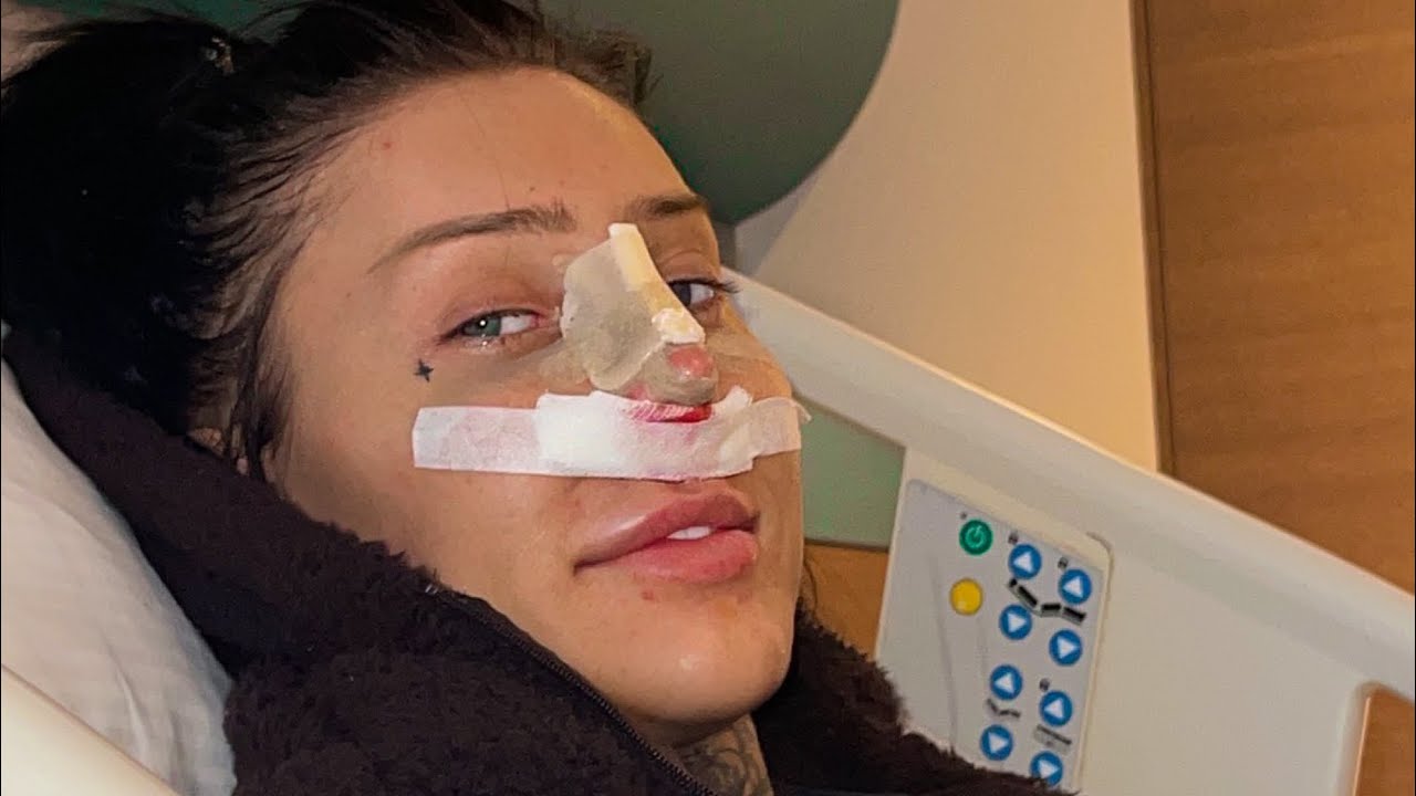 MIJN 3E NEUS OPERATIE… ! | Keeping Up With Jessie