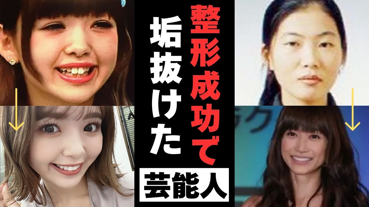 【有益2ch】決め手は引き算！美容整形が大成功して垢抜けた芸能人【ガルちゃん】