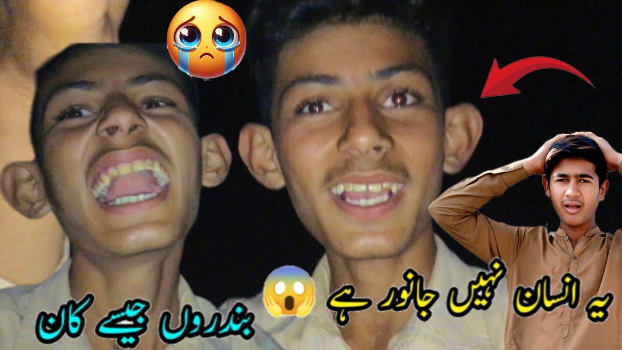Ya Insan Nahi Janvar Hai 🥺😱 بندروں جیسے کان 