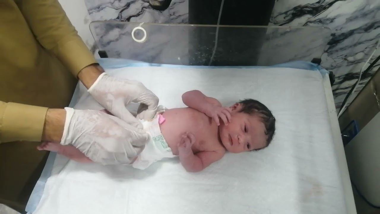 Newborn with Meconium Aspiration Syndrome (MAS) | NICU Emergency Care🩺🩺🥀🥀💉💉☣