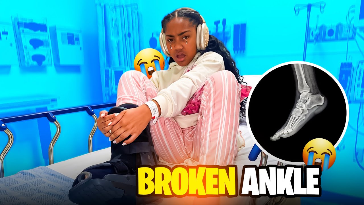 I BROKE MY ANKLE ! 😱🦶