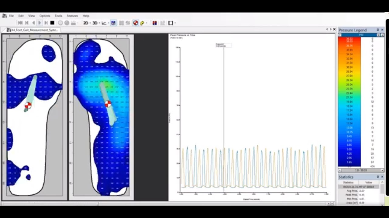 Capture Dynamic Lab-Quality Data with XSENSOR's Fully-Wireless Intelligent Insole | Pro System
