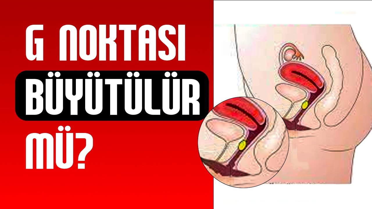 G Noktası Nedir? Nerede Bulunur? G Noktası Büyütme İşlemi Kalıcı Mıdır? - Doç. Dr. Aydın Köşüş