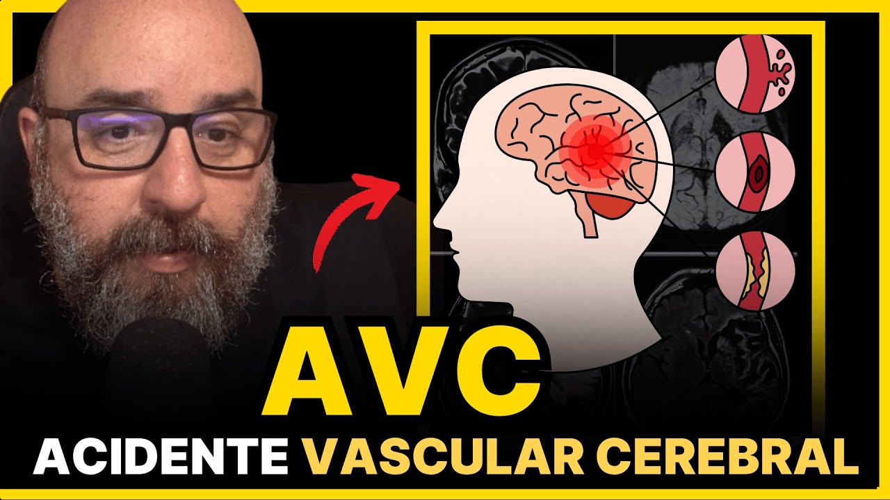 O QUE É UM AVC? POR QUE É TÃO PERIGOSO?