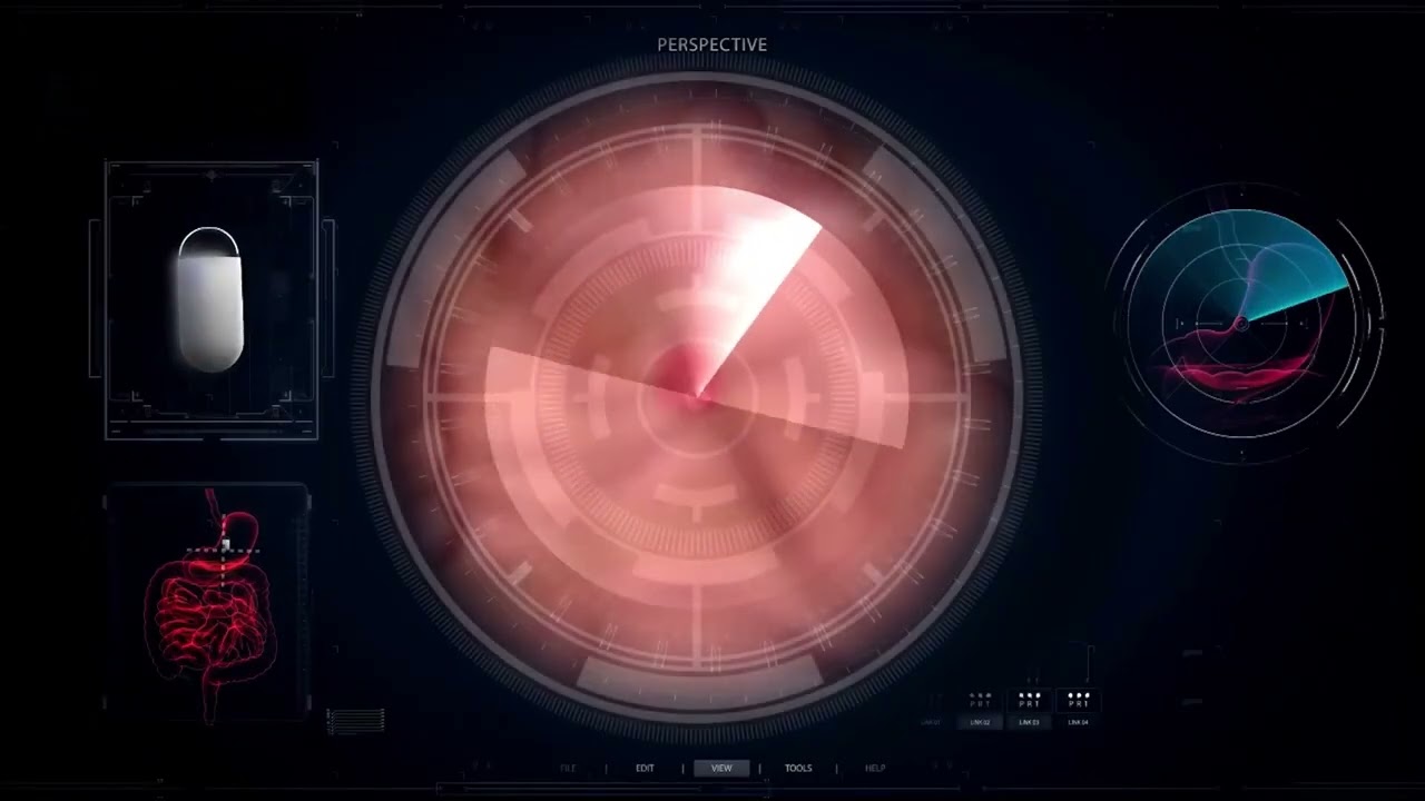 NaviCam - Stomach Capsule Endoscopy
