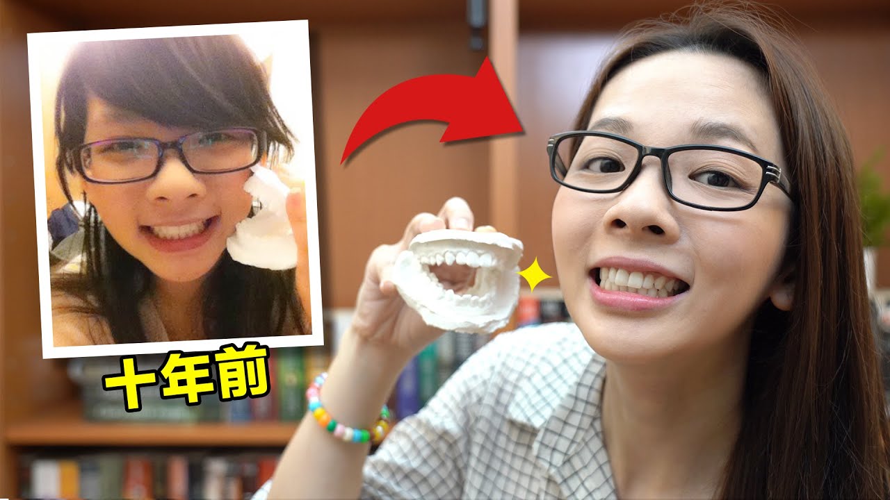 公開10年前照片! 滴妹戴牙套的辛酸史! (中英雙字幕)