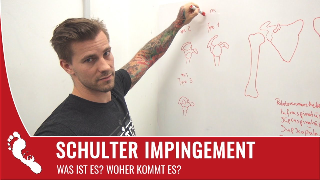 Impingement Syndrom | Bedeutung & Ursachen