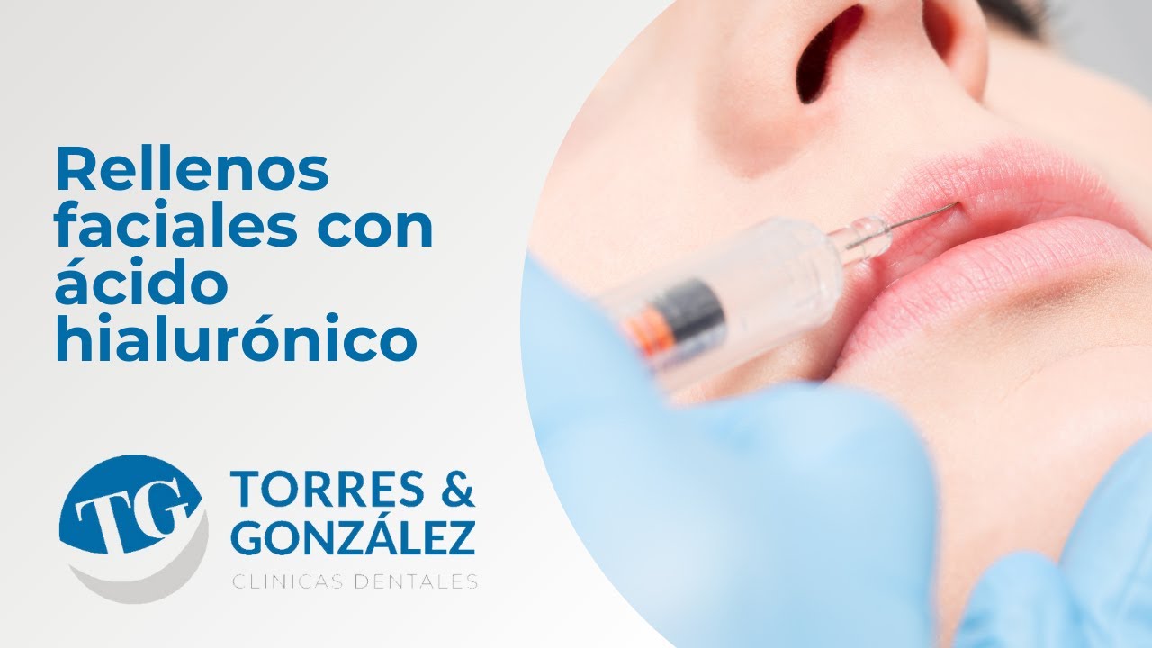 Relleno facial, labio con ácido hialurónico. Torres & González